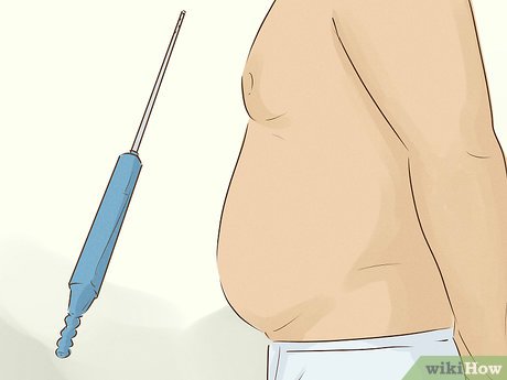 Step 4 Consider liposuction.